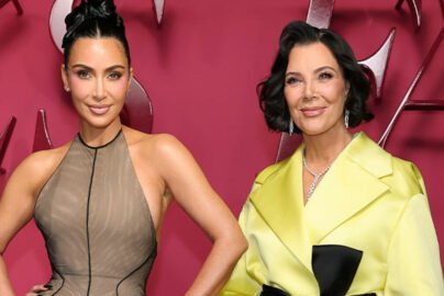 kris jenner face lift